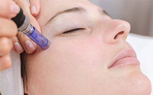 Micro Needling